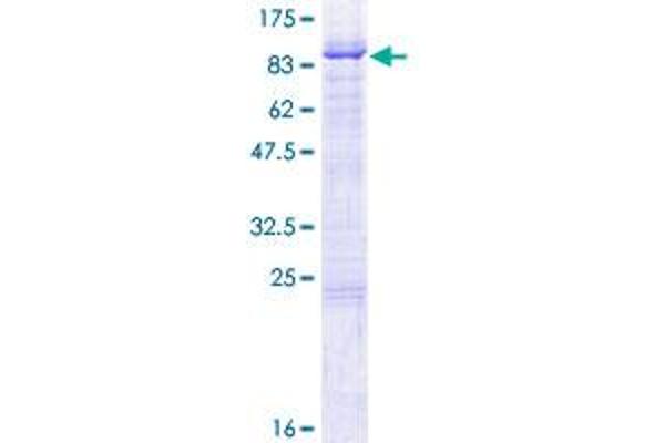 BIRC2 Protein (AA 1-618) (GST tag)