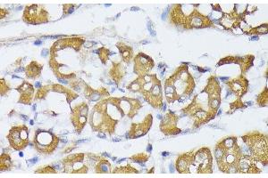 Immunohistochemistry of paraffin-embedded Human stomach using VAPA Polyclonal Antibody at dilution of 1:100 (40x lens). (VAPA 抗体)