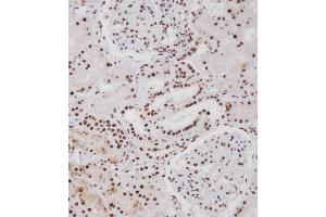 Immunohistochemical analysis of A on paraffin-embedded Human kidney tissue. (ERBB4 抗体  (pTyr1188))