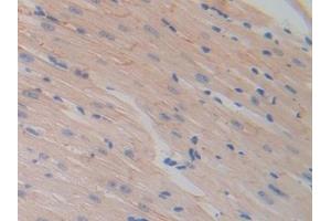 Detection of HEXb in Mouse Heart Tissue using Polyclonal Antibody to Hexosaminidase B Beta (HEXb)