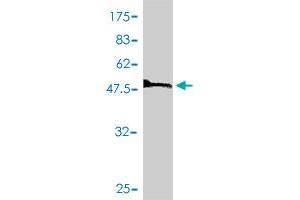 Western Blotting (WB) image for anti-Solute Carrier Family 25 (Mitochondrial Carrier, Oxoglutarate Carrier), Member 11 (SLC25A11) (AA 1-314) antibody (ABIN563610)