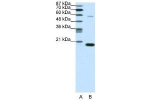 WB Suggested Anti-CBX3  Antibody Titration: 0. (CBX3 抗体  (Middle Region))