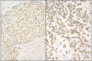 Immunohistochemistry (IHC) image for anti-Glucocorticoid Modulatory Element Binding Protein 1 (GMEB1) (AA 523-573) antibody (ABIN7454862)