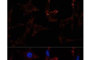Immunofluorescence analysis of NIH/3T3 cells using RALA Polyclonal Antibody at dilution of 1:100. (rala 抗体)