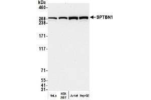 Western Blotting (WB) image for anti-Spectrin Beta, Non-Erythrocytic 1 (SPTBN1) (AA 2100-2150) antibody (ABIN7454694) (SPTBN1 抗体  (AA 2100-2150))