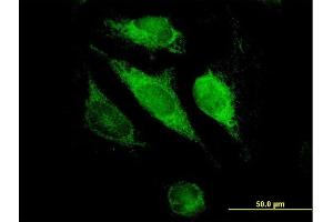 Immunofluorescence of purified MaxPab antibody to GSTK1 on HeLa cell. (GSTK1 抗体  (AA 1-226))