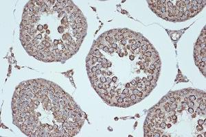 Immunohistochemistry of paraffin-embedded rat testis using Smac/Diablo Rabbit mAb (ABIN7270177) at dilution of 1:100 (40x lens). (DIABLO 抗体)