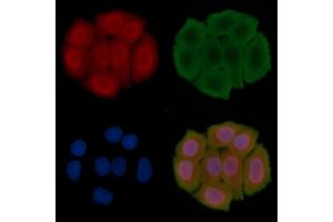 ABIN6266359 and ABIN6276704 staining Hela cells(30 min of UV treatment) by IF/ICC. (PRMT5 抗体  (Internal Region))