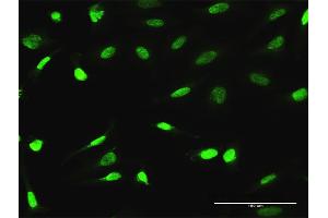 Immunofluorescence of purified MaxPab antibody to ESRRA on HeLa cell. (ESRRA 抗体  (AA 1-423))