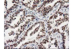 Image no. 7 for anti-Protein Kinase C, epsilon (PRKCE) antibody (ABIN1500229)