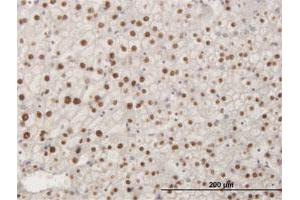 Immunohistochemistry (Formalin-fixed Paraffin-embedded Sections) (IHC (fp)) image for anti-SMAD, Mothers Against DPP Homolog 6 (SMAD6) (AA 285-384) antibody (ABIN517653)