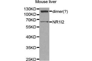 Western Blotting (WB) image for anti-Nuclear Receptor Subfamily 1, Group I, Member 2 (NR1I2) (AA 100-200) antibody (ABIN3015525) (NR1I2 抗体  (AA 100-200))