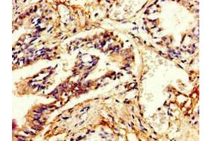 Immunohistochemistry of paraffin-embedded human lung tissue using ABIN7146632 at dilution of 1:100 (PDE4B 抗体  (AA 27-215))