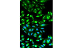 Immunofluorescence analysis of HeLa cell using RHOC antibody. (RHOC 抗体)