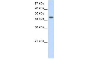 YARS antibody used at 2. (YARS 抗体  (C-Term))