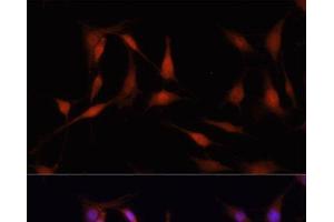 Immunofluorescence analysis of PC12 cells using FKBP5 Polyclonal Antibody at dilution of 1:100. (FKBP5 抗体)