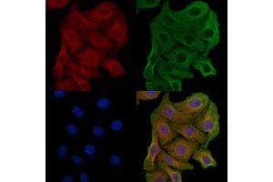 ABIN6257586 and ABIN6274837 staining Hela cells by IF/ICC. (AMPD2 抗体  (N-Term))