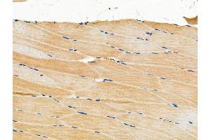 ABIN6263703 and ABIN6276760 at 1/100 staining Mouse muscle tissue by IHC-P. (NPPA 抗体  (C-Term))