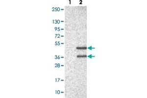 Western blot analysis of Lane 1: Negative control (vector only transfected HEK293T lysate). (UFD1L 抗体)