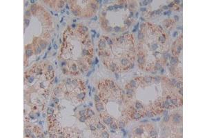 Used in DAB staining on fromalin fixed paraffin- embedded kidney tissue (PDP2 抗体  (AA 1-186))