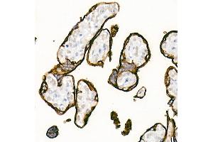 Immunohistochemistry of paraffin-embedded Human placenta using Placental alkaline phosphatase (PLAP) antibody (ABIN1682693, ABIN7101664, ABIN7101665 and ABIN7101666) at dilution of 1:1000 (40x lens). (PLAP 抗体)