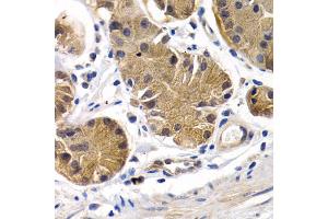 Immunohistochemistry of paraffin-embedded human stomach using PTGIR antibody. (Prostacyclin Receptor 抗体)