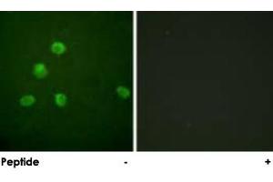 Immunofluorescence analysis of HepG2 cells, using FOSB polyclonal antibody . (FOSB 抗体)