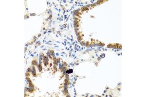 Immunohistochemistry of paraffin-embedded rat lung using C8orf4 antibody (ABIN5975014) at dilution of 1/100 (40x lens). (C8orf4 抗体)