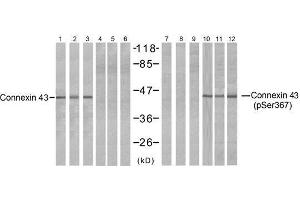 Western blot analysis of extracts from HeLa (Line 1, 4, 7 and 10), K562 (Line 2, 5, 8 and 11) and 293 (Line 3, 6, 9 and 12) cells, untreated or treated with PMA (1ηM 30min), using Connexin43 (Ab-367) antibody (E021250, Lane 1, 2, 3, 4, 5 and 6) and Connexin43 (phospho-Ser367) antibody (E011258, Lane 7, 8, 9, 10, 11 and 12). (Connexin 43/GJA1 抗体)