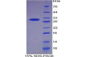 SDS-PAGE analysis of Rat SOD3 Protein. (SOD3 蛋白)
