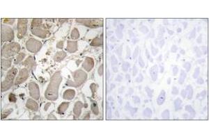 Immunohistochemistry (IHC) image for anti-Collagen, Type V, alpha 1 (COL5A1) (AA 301-350) antibody (ABIN2889916) (COL5A1 抗体  (AA 301-350))