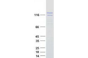 Validation with Western Blot (SYTL2 Protein (Transcript Variant A) (Myc-DYKDDDDK Tag))