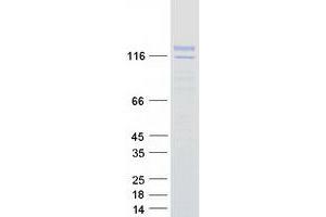 Western Blotting (WB) image for Synaptotagmin Like Protein 2 (SYTL2) (Transcript Variant A) protein (Myc-DYKDDDDK Tag) (ABIN2733138)