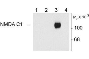 Image no. 1 for anti-NMDA Receptor 1 (NMDA R1) (Splice Variant C1) antibody (ABIN372675) (NMDA 1 Receptor 抗体  (Splice Variant C1))