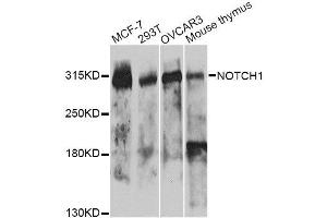 Western blot analysis of extracts of various cell lines, using NOTCH1 antibody. (Notch1 抗体)