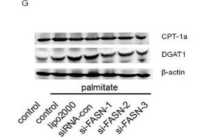 Western Blotting (WB) image for anti-Carnitine Palmitoyltransferase 1A (Liver) (CPT1A) (AA 497-756) antibody (ABIN6138976)