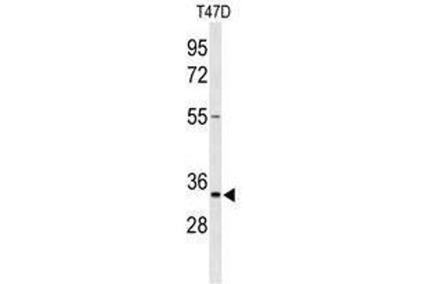 TSPAN33 抗体  (C-Term)