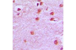 Immunohistochemical analysis of HOXA11/D11 staining in human brain formalin fixed paraffin embedded tissue section. (HOXA11/D11 抗体  (C-Term))