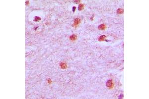 Immunohistochemical analysis of HOXA11/D11 staining in human brain formalin fixed paraffin embedded tissue section.