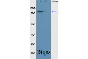 SDS-PAGE (SDS) image for anti-Solute Carrier Family 9, Subfamily A (NHE1, Cation Proton Antiporter 1), Member 1 (SLC9A1) (AA 470-550) antibody (ABIN669426)