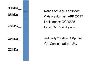 Western Blotting (WB) image for anti-serum/glucocorticoid Regulated Kinase Family, Member 3 (SGK3) (C-Term) antibody (ABIN2786286) (SGK3 抗体  (C-Term))