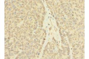 Immunohistochemistry (IHC) image for anti-Ankyrin Repeat, SAM and Basic Leucine Zipper Domain Containing 1 (ASZ1) (AA 1-200) antibody (ABIN7144247)