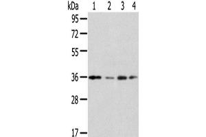 Western Blot analysis of Jurkat, A549, HepG2 and 293T cells using HOXD13 Polyclonal Antibody at dilution of 1/200 (Homeobox D13 抗体)