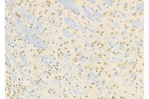 ABIN6258821 and ABIN6274163 at 1/100 staining Mouse brain tissue by IHC-P. (HKR1 抗体)