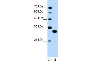 WB Suggested Anti-TFEC Antibody Titration:  0. (TFEC 抗体  (N-Term))