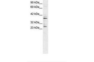 Image no. 1 for anti-Sirtuin 5 (SIRT5) (C-Term) antibody (ABIN6735783) (SIRT5 抗体  (C-Term))