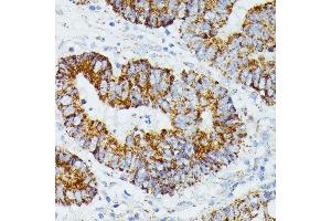 Immunohistochemistry (IHC) image for anti-Ethylmalonic Encephalopathy 1 (ETHE1) (AA 8-245) antibody (ABIN6140319)