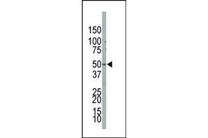 Western Blotting (WB) image for anti-Phosphatidylinositol-5-Phosphate 4-Kinase, Type II, beta (PIP4K2B) (AA 286-317), (C-Term) antibody (ABIN392600)