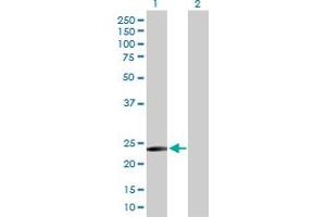 Western Blot analysis of TXNDC9 expression in transfected 293T cell line by TXNDC9 MaxPab polyclonal antibody.