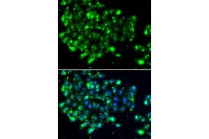 Immunofluorescence analysis of MCF7 cell using NAT9 antibody. (NAT9 抗体)